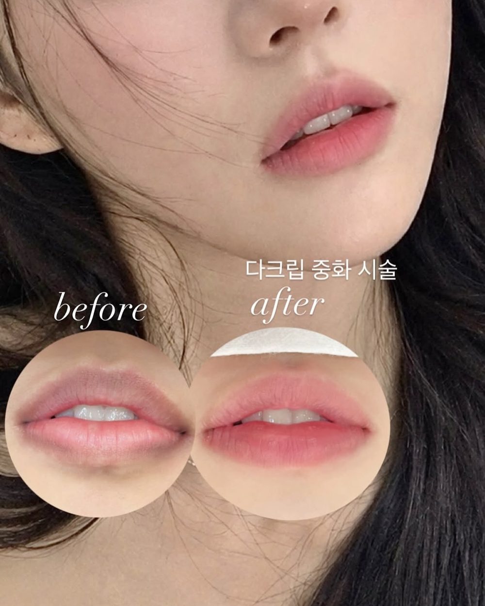 브로우원 분당 눈썹문신 시술 전후 사진 2